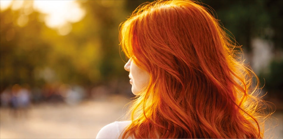 상처 회복 더디다?…붉은 머리 유전자의 비밀